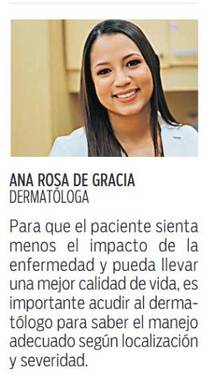 $!Cuidado e higiene, claves para prevenir la dermatitis seborreica