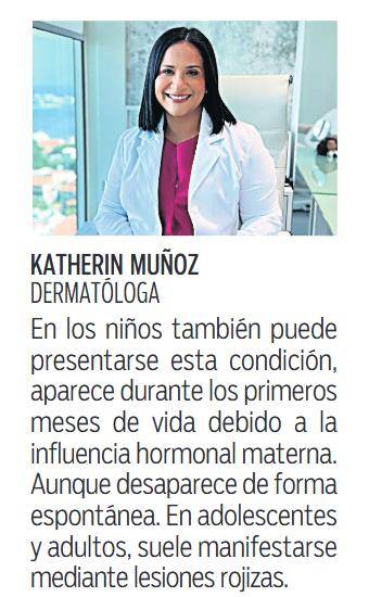 $!Cuidado e higiene, claves para prevenir la dermatitis seborreica