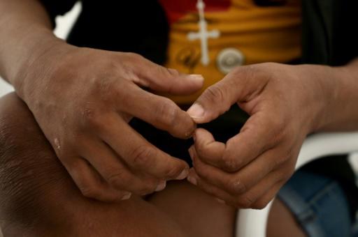 La H, la droga que carcome a los más pobres en Ecuador