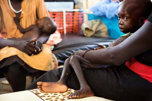 Wek Wol Wek, de tres años, que sufre malnutrición aguda, recibe atención en una clínica gestionada por la ONG Médicos Sin Fronteras en Aweil, en Sudán del Sur, el 11 de octubre de 2016