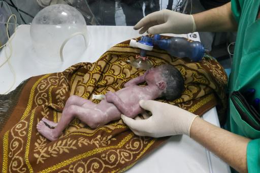 Un médico palestino atiende a una bebé nacida prematuramente después de su madre fuera herida en un bombardeo siraelí, el 20 de abril de 2024 en el hospital Kuwait de Rafah, al sur de la Franja de Gaza