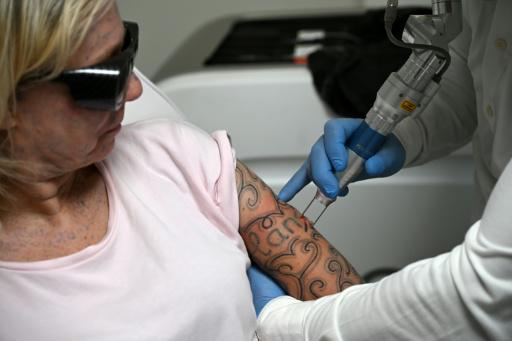 La metamorfosis de las mujeres tatuadas a la fuerza en Países Bajos