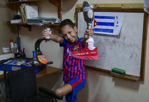 Juan José Guilarte posa para una fotografía con sus prótesis en su casa, en La Habana, el 22 de abril de 2026.
