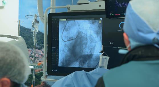 La CSS beneficia a 80 pacientes con cateterismos en Ciudad de la Salud