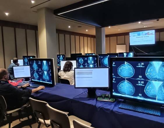 La IA ayuda a los médicos a detectar el cáncer de mama en los cribados, según un estudio