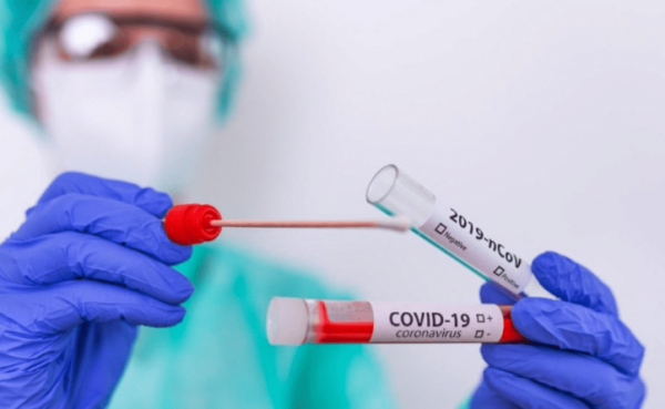 Panamá registró 7,966 nuevos contagios por Covid-19 en la última semana