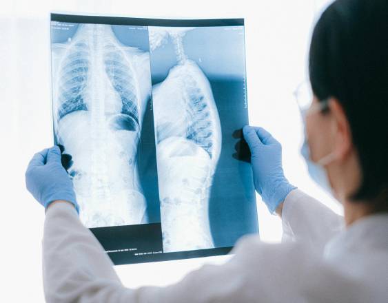 Pexels | Los distintos tipos de cáncer de pulmón.