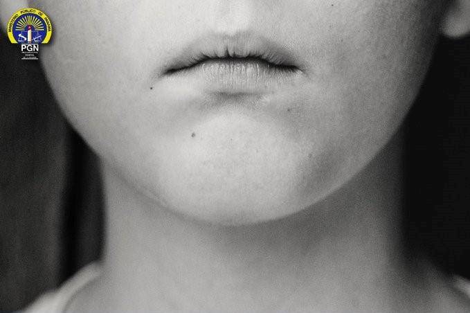 Mujer que agredió a niña de 13 años en Los Andes quedará detenida por tentativa de homicidio