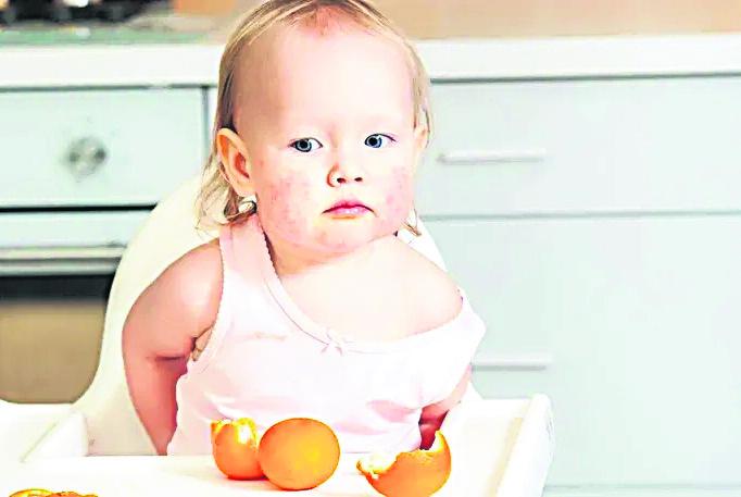 Intolerancias, enemigas del sistema digestivo