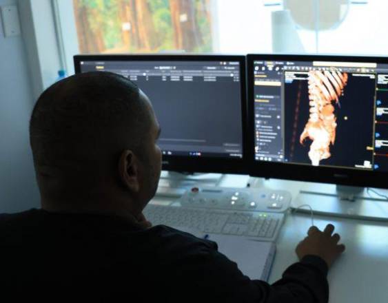 Ponen en funcionamiento tomógrafo con Inteligencia Artificial en el Complejo Hospitalario de la CSS