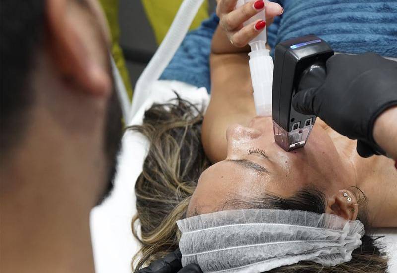 Morpheus 8, una “máquina del tiempo” para rejuvenecer la piel