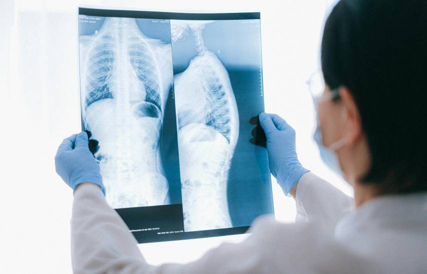 Pexels | Los distintos tipos de cáncer de pulmón.