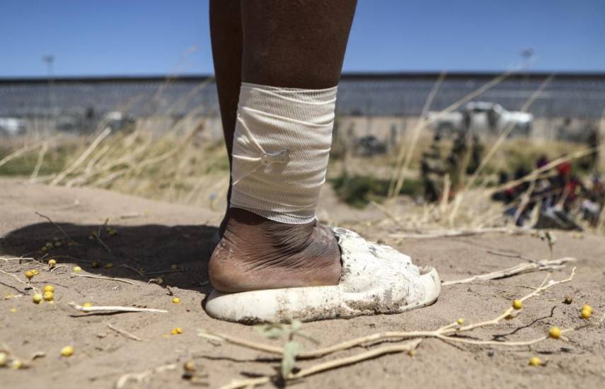 HERIKA MARTINEZ / AFP | Una mujer inmigrante con una lesión en la pierna.