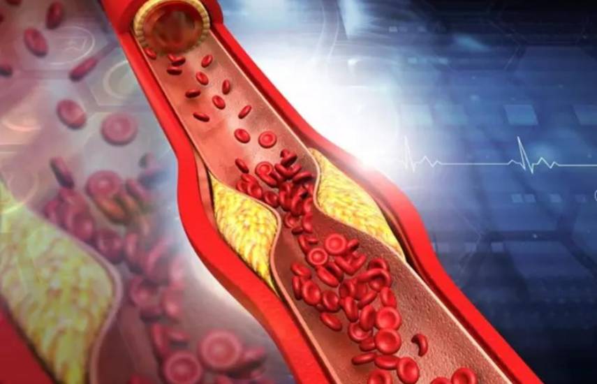 ¿Reducir el colesterol con una vacuna? Está más cerca de lo que piensas