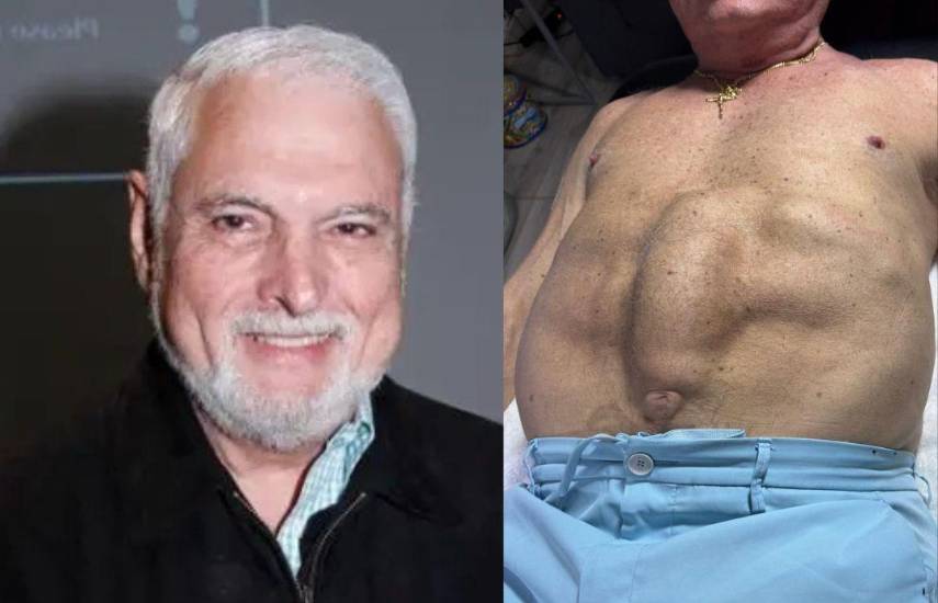 Ricardo Martinelli reitera que le urge realizarse dos operaciones