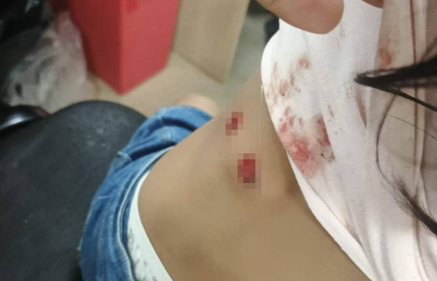 Investigan supuesto abuso policial durante patrullaje en Bocas del Toro