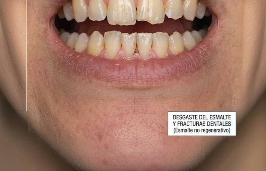 Onicofagia, un riesgo silencioso