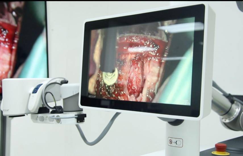 Hospital Chicho Fábrega moderniza cirugías con exoscopio robótico