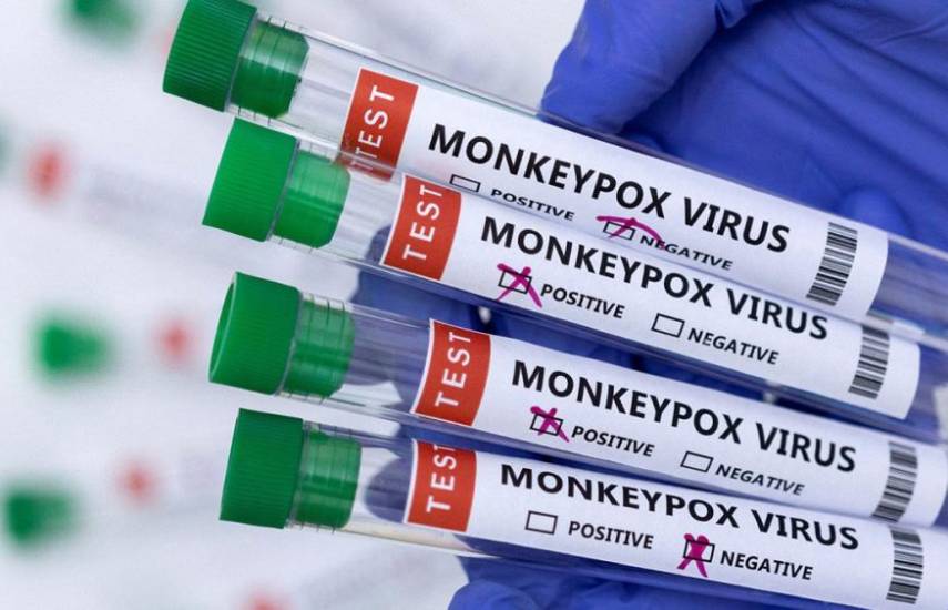 Panamá acumula 235 casos de viruela símica, según el Minsa